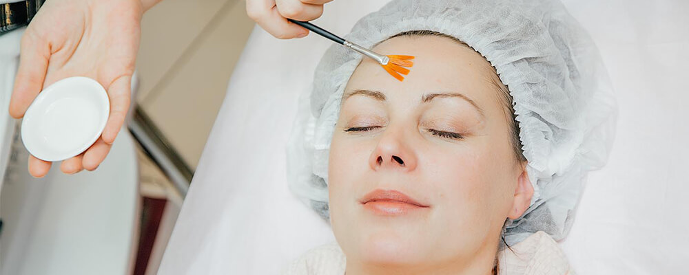 Are Chemical Peels the Secret to Great Skin